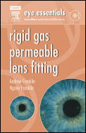 Eye Essentials: Rigid Gas-Permeable Lens Fitting